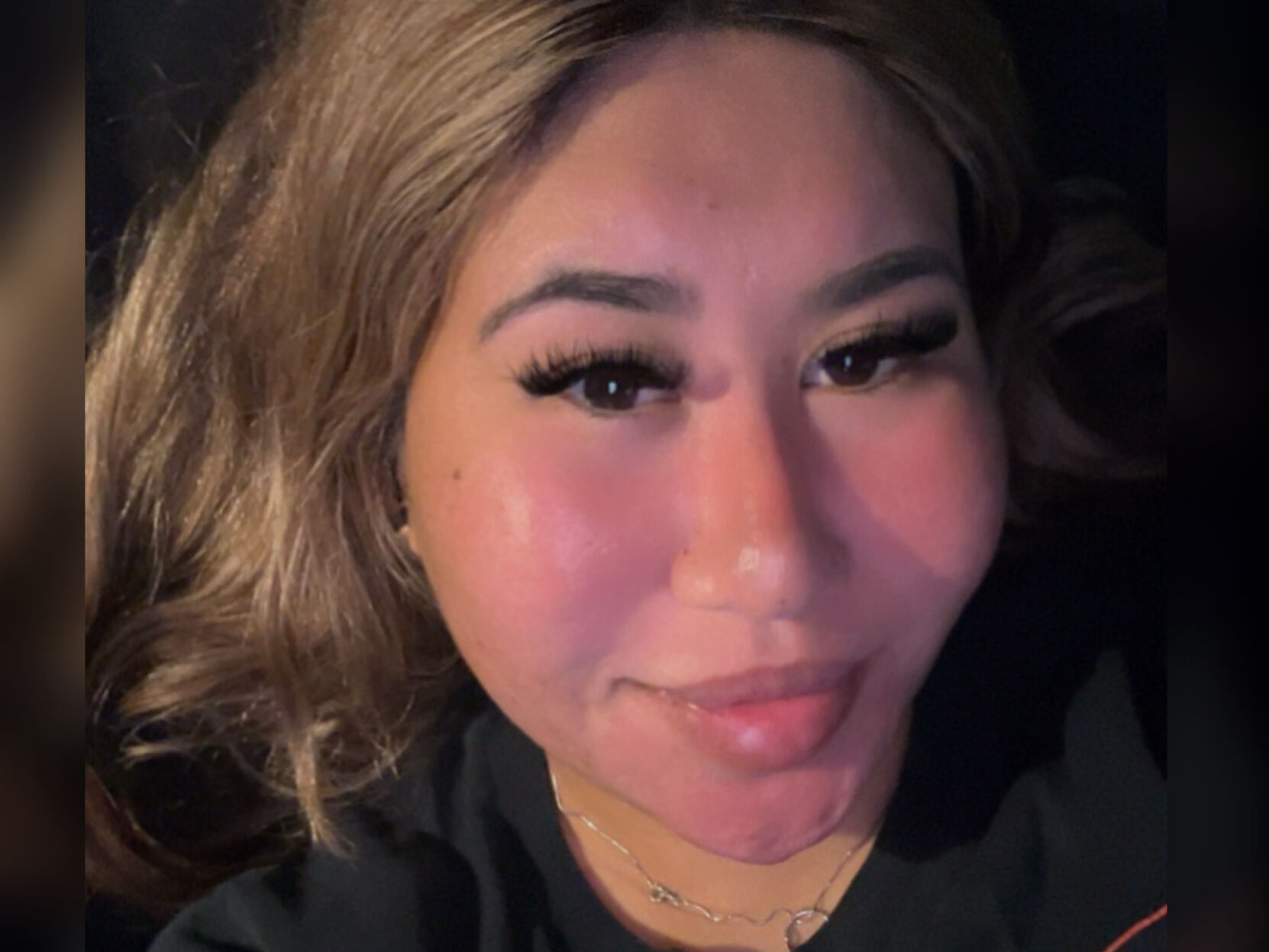 Column: Having acne can be a lot for teenagers and adults, emotionally and physically